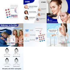 Star Pimple Patches for Face USA Stars themed design-Hydrocolloid Acne Patches - Pimple Patches Cute - 14MM Sizes Zit Stickers-72 Patches Blemish Pimple Dots