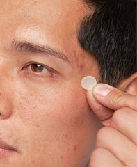 omadoto microdart pimple patches