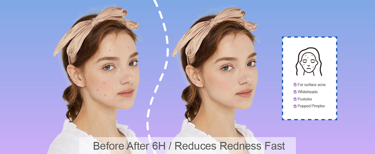 EFFECTS COMPARISON OF USAGE