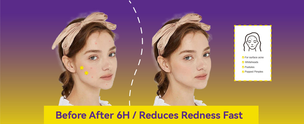 COMPARISON OF USAGE EFFECTS