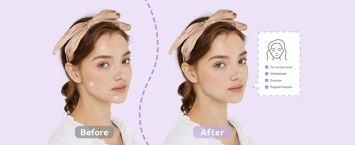 EFFECTS COMPARISON OF USAGE